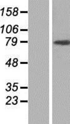 Western Blot: ARHGAP12 Overexpression Lysate [NBP2-06820]