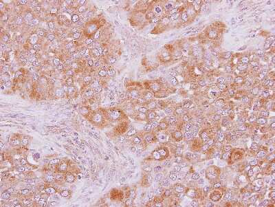 Immunohistochemistry-Paraffin: ARHGAP15 Antibody [NBP2-15452]