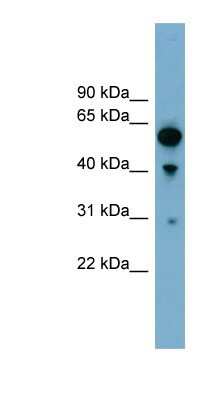 Western Blot: ARHGAP15 Antibody [NBP1-56885]