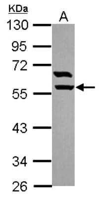 Western Blot: ARHGAP15 Antibody [NBP2-15452]