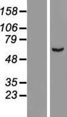 Western Blot: ARHGAP15 Overexpression Lysate [NBL1-07666]