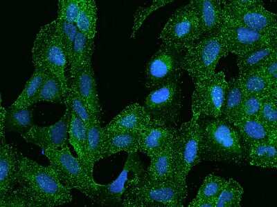 Immunocytochemistry/ Immunofluorescence: ARHGAP17 Antibody [NBP2-97377]