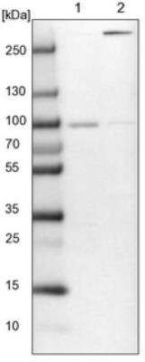 Western Blot: ARHGAP17 Antibody [NBP1-83870]