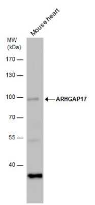 Western Blot: ARHGAP17 Antibody [NBP2-43545]