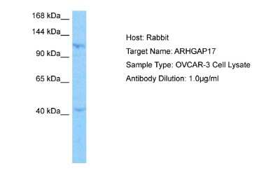 Western Blot: ARHGAP17 Antibody [NBP2-84449]