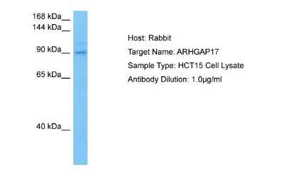 Western Blot: ARHGAP17 Antibody [NBP2-84450]