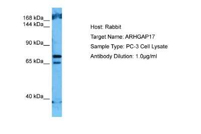 Western Blot: ARHGAP17 Antibody [NBP2-84451]