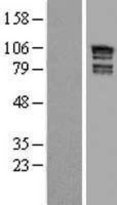 Western Blot: ARHGAP17 Overexpression Lysate [NBL1-07667]