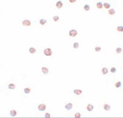 Immunocytochemistry/ Immunofluorescence: ARHGAP18 Antibody - BSA Free [NBP2-81704]