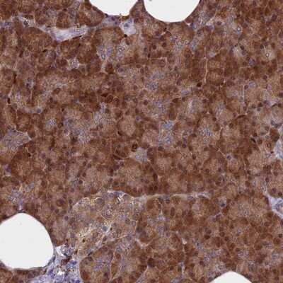 Immunohistochemistry-Paraffin: ARHGAP18 Antibody [NBP1-94131]