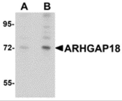 Western Blot: ARHGAP18 AntibodyBSA Free [NBP2-81704]