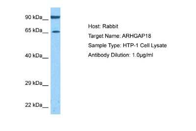 Western Blot: ARHGAP18 Antibody [NBP2-82653]