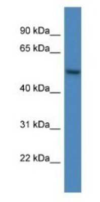 Western Blot: ARHGAP19 Antibody [NBP1-91512]