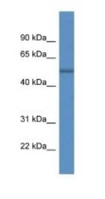 Western Blot: ARHGAP19 Antibody [NBP1-91513]