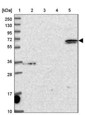 Western Blot: ARHGAP19 Antibody [NBP1-94047]