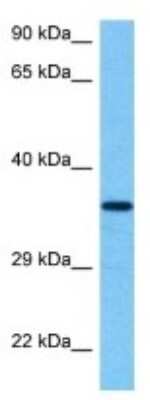 Western Blot: ARHGAP19 Antibody [NBP3-10823]