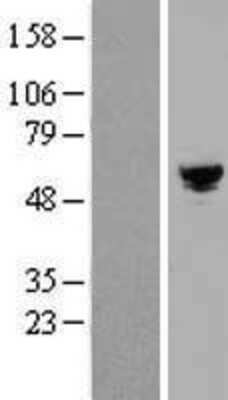 Western Blot: ARHGAP19 Overexpression Lysate [NBP2-05953]