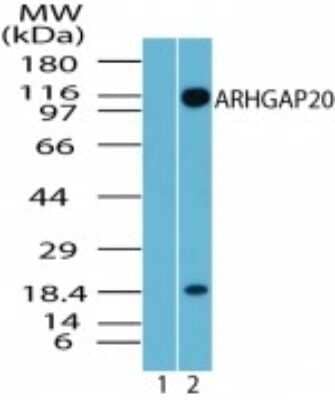 Western Blot: ARHGAP20 AntibodyAzide Free [NBP2-33261]