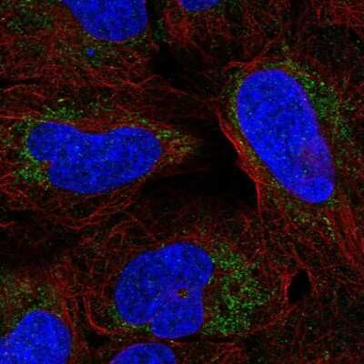 Immunocytochemistry/ Immunofluorescence: ARHGAP20 Antibody [NBP2-56355]