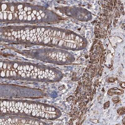 Immunohistochemistry: ARHGAP20 Antibody [NBP2-38414]