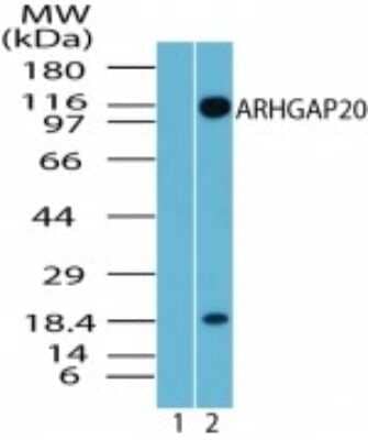 Western Blot: ARHGAP20 Antibody [NBP2-24757]