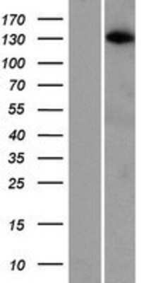 Western Blot: ARHGAP20 Overexpression Lysate [NBP2-06602]