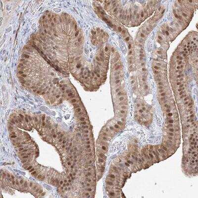 Immunohistochemistry-Paraffin: ARHGAP21 Antibody [NBP1-90852]