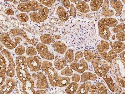 Immunohistochemistry-Paraffin: ARHGAP21 Antibody [NBP3-06052]