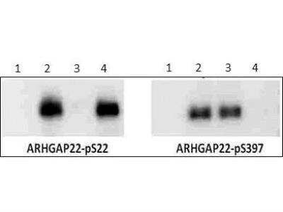 Western Blot: ARHGAP22 [p Ser22] Antibody [NBP1-44072]