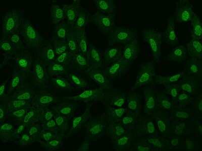 Immunocytochemistry/ Immunofluorescence: ARHGAP22 Antibody [NBP2-97913]