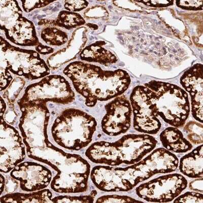 Immunohistochemistry: ARHGAP22 Antibody [NBP2-38465]