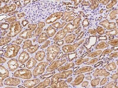 Immunohistochemistry-Paraffin: ARHGAP22 Antibody [NBP2-97912]