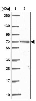 Western Blot: ARHGAP22 Antibody [NBP2-39028]