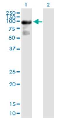 Western Blot: ARHGAP24 Antibody [H00083478-B01P]