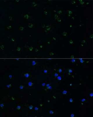 Immunocytochemistry/ Immunofluorescence: ARHGAP25 Antibody - BSA Free [NBP2-92851]