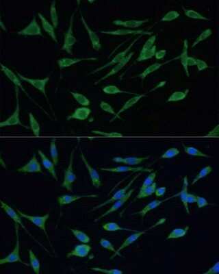 Immunocytochemistry/ Immunofluorescence: ARHGAP25 Antibody - BSA Free [NBP2-92851]