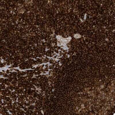 Immunohistochemistry-Paraffin: ARHGAP25 Antibody [NBP1-83053]