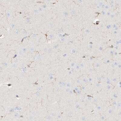 Immunohistochemistry-Paraffin: ARHGAP25 Antibody [NBP1-83053]