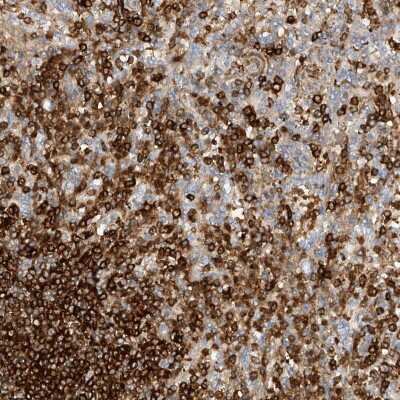 Immunohistochemistry-Paraffin: ARHGAP25 Antibody [NBP1-83053]