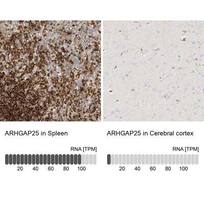 Immunohistochemistry-Paraffin: ARHGAP25 Antibody [NBP1-83053]