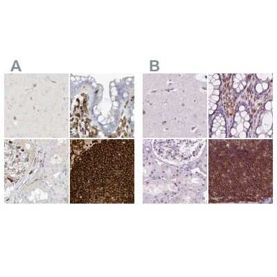 Immunohistochemistry-Paraffin: ARHGAP25 Antibody [NBP1-83053]