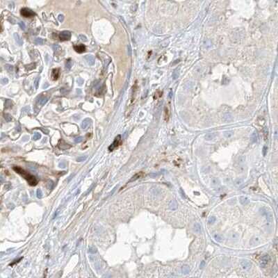 Immunohistochemistry-Paraffin: ARHGAP25 Antibody [NBP1-83053]