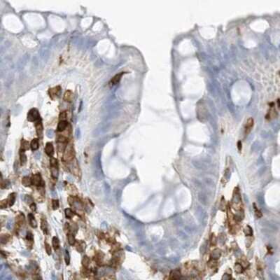 Immunohistochemistry-Paraffin: ARHGAP25 Antibody [NBP1-83053]