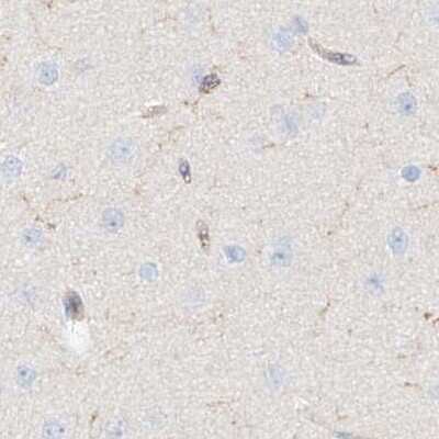 Immunohistochemistry-Paraffin: ARHGAP25 Antibody [NBP1-83053]