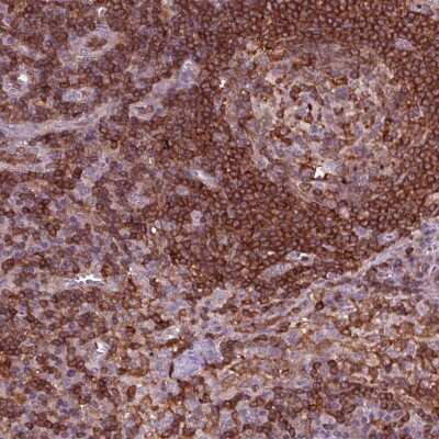 Immunohistochemistry-Paraffin: ARHGAP25 Antibody [NBP2-57228]