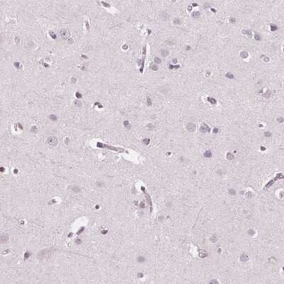 Immunohistochemistry-Paraffin: ARHGAP25 Antibody [NBP2-57228]
