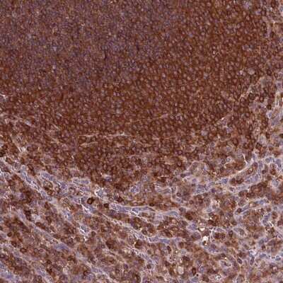 Immunohistochemistry-Paraffin: ARHGAP25 Antibody [NBP2-57228]