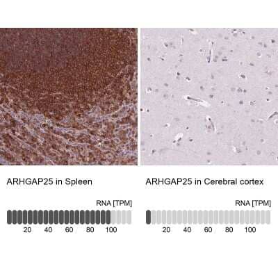 Immunohistochemistry-Paraffin: ARHGAP25 Antibody [NBP2-57228]