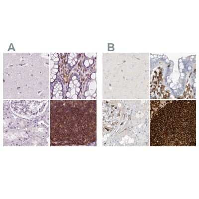 Immunohistochemistry-Paraffin: ARHGAP25 Antibody [NBP2-57228]