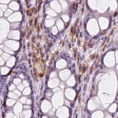 Immunohistochemistry-Paraffin: ARHGAP25 Antibody [NBP2-57228]